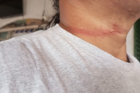 Linha chilena quase provoca tragédia em Pedro Leopoldo e acende alerta sobre uso de material cortante em pipas